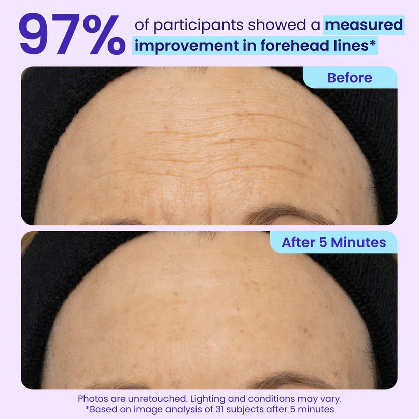 ✨Last Day 50% Off Erase Eye Bags in Minutes — Look Refreshed Instantly