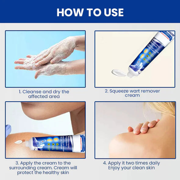 Kasperfect TM WartsOff Instant Blemish Removal Cream