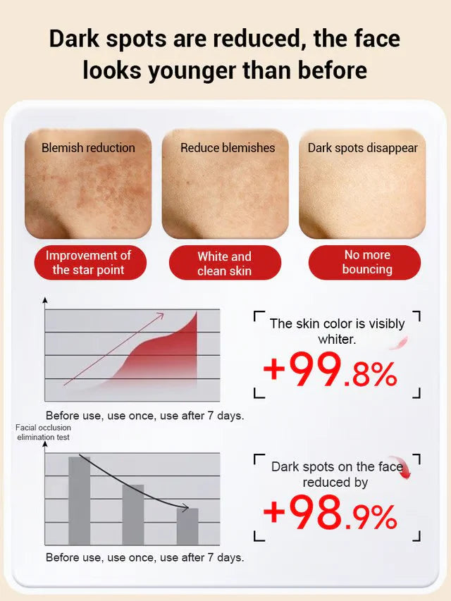 Upgraded anti-freckle essence oil