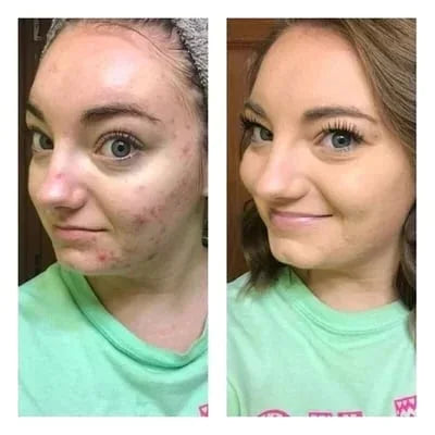 đTri-color concealer - Moisturizing and long-lastingđŠ