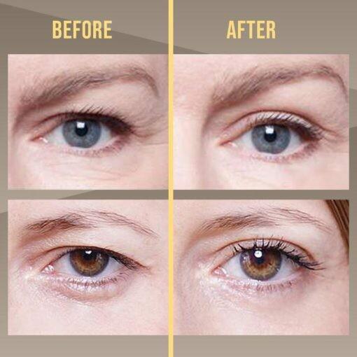 3 Second Crease Double Eyelid Pen