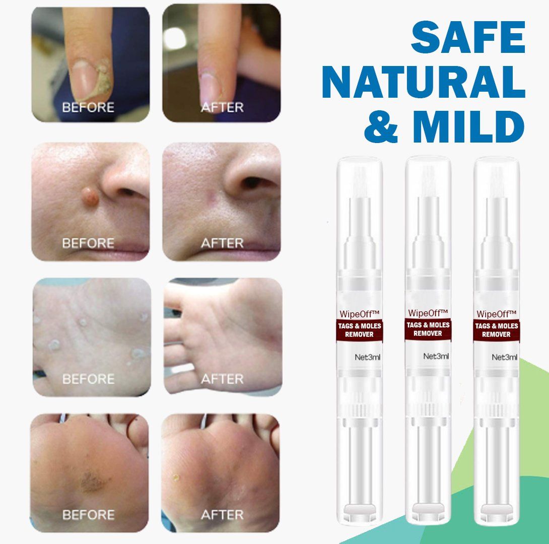 WipeOff Tags Moles Remover