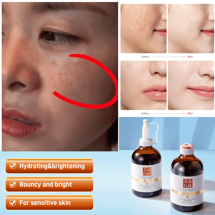 Intensive Whitening and Anti-Blemish Serum Oil