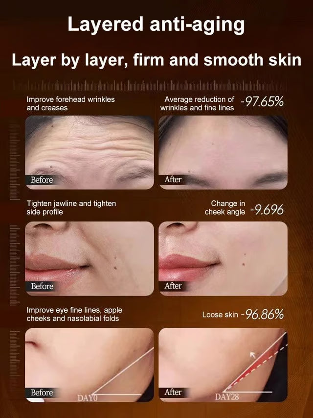 🏆Flash Sale⚡Micro-Molecular Collagen Anti-Wrinkle Lotion