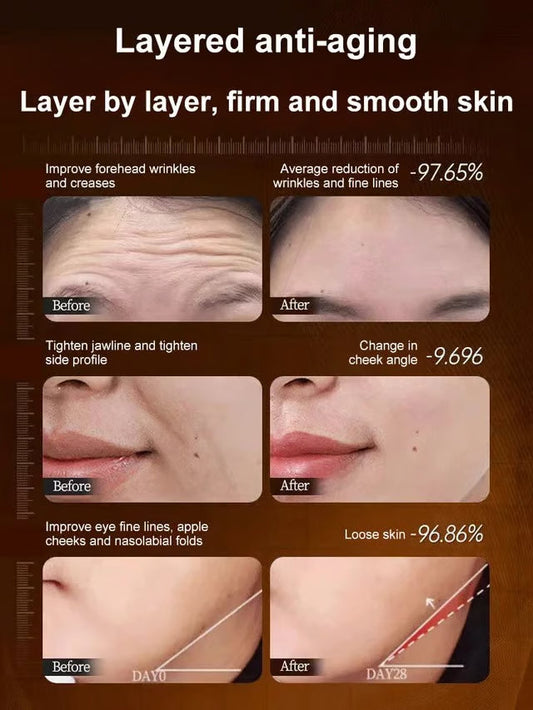 🏆Flash Sale⚡Micro-Molecular Collagen Anti-Wrinkle Lotion