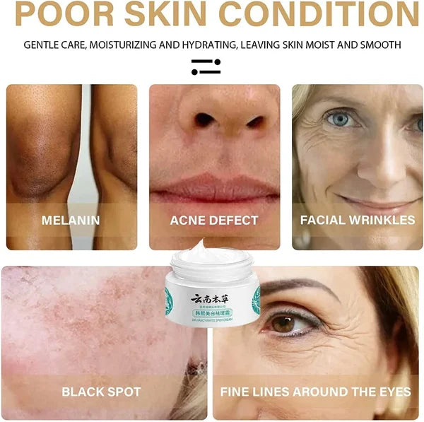 🔥BUY 1 GET 1 (2PCS)🔥 - 🌿Yunnan Herbal Whitening and Freckle-Removing Cream